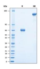 SDS-PAGE (EPCAM-051H).jpg